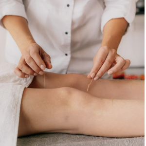 Acupuncturist administering acupuncture treatment on a patient's knee, employing fine needles as part of the therapeutic session
