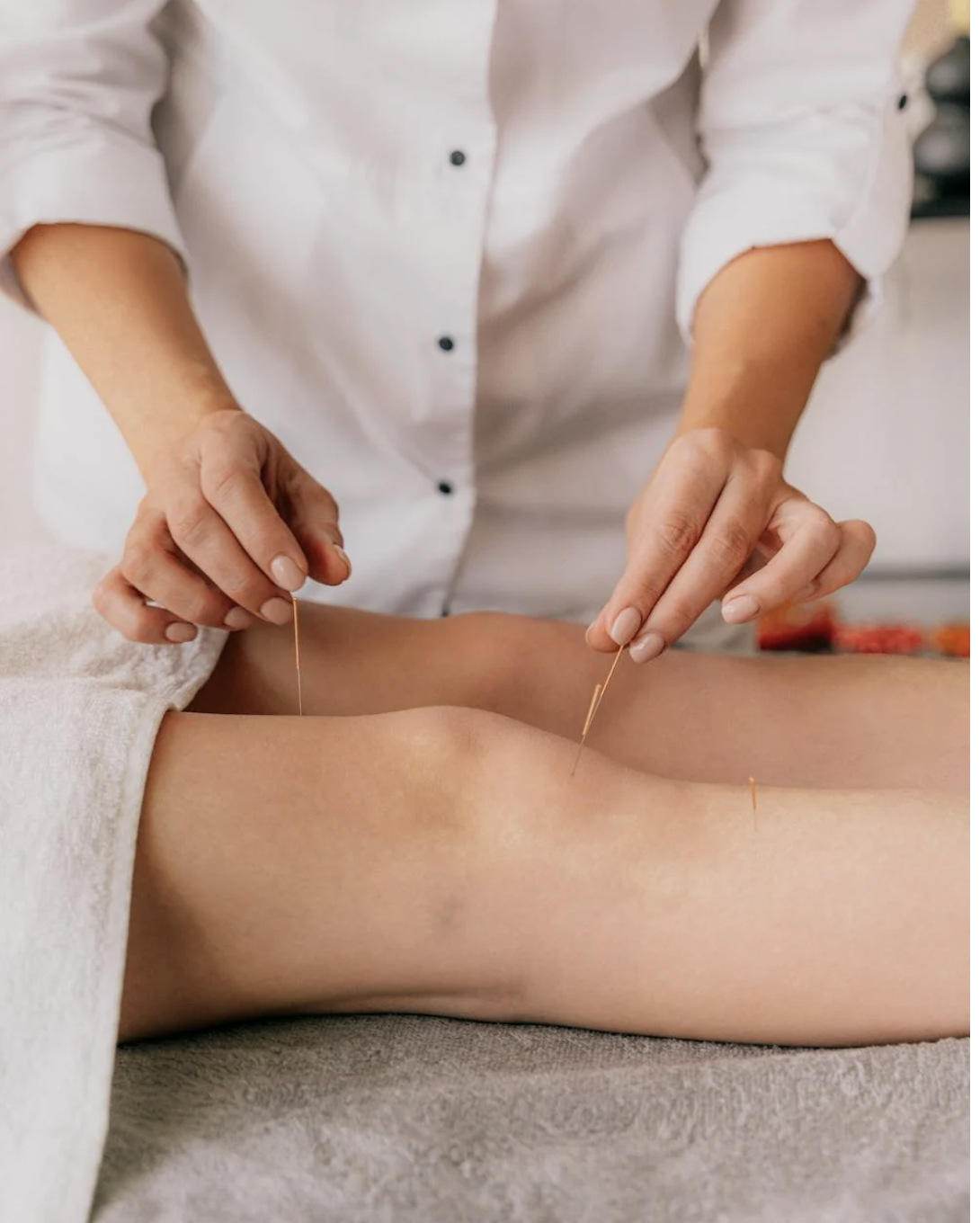 Acupuncturist administering acupuncture treatment on a patient's knee, employing fine needles as part of the therapeutic session